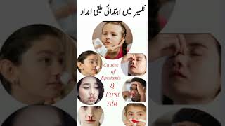 Epistaxis amp first aid  Epistaxis amp treatment  Epistaxis amp diet  Epistaxis amp prevention [upl. by Agnot444]