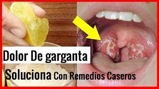 Alivia El Dolor De Garganta En 2 Horas 5 Remedios Caseros [upl. by Ras559]