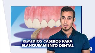 BLANQUEAMIENTO dental en CASA  ¿Se puede blanquear los dientes con bicarbonato y limón  Shorts [upl. by Ehcrop]