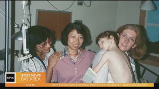 Still beating strong A look back at a historic Bay Area heart transplant [upl. by Gniw679]