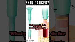 Skin Cancer Dont Ignore The Warning Signs [upl. by Marquez]