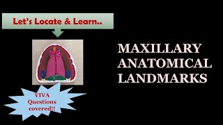 MAXILLARY ANATOMICAL LANDMARKS  MARKING ON MODEL  DENTURE BEARING AREA [upl. by Frangos692]