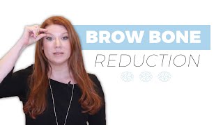 What is a Brow Bone Reduction [upl. by Betsey95]