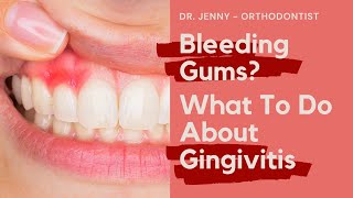 DentistOrthodontist Explains Bleeding Gums amp What To Do About Gingivitis [upl. by Anialad]