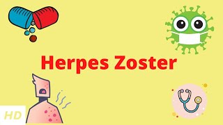 Herpes Zoster Causes Signs and Symptoms Diagnosis and Treatment [upl. by Sosna]