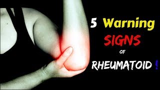 5 Warning Signs Of Rheumatoid Arthritis  DONT IGNORE [upl. by Ogilvy]