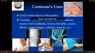 Your guide to cortisone injections [upl. by Ingmar]