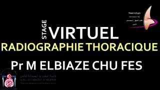 2 conditions de réalisation pour une bonne qualité de radiographie thoracique [upl. by Lytsyrk]