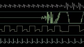 Elrico amp LHS  Elrico VS LHS Oscilloscope View [upl. by Theis773]