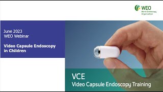 Video Capsule Endoscopy in Children [upl. by Elenore]