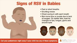 Signs amp Symptoms of RSV in Babies  AAP [upl. by Ranip]