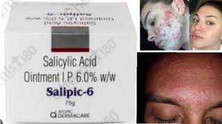 Salipic 6 Ointment Cream Salicylic Acid Ointment IP 60 ww [upl. by Venuti573]