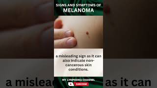 Signs and Symptoms of Melanoma shorts [upl. by Akemihs]