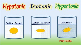 Hypertonic Isotonic amp Hypotonic Solutions [upl. by Kerwinn]