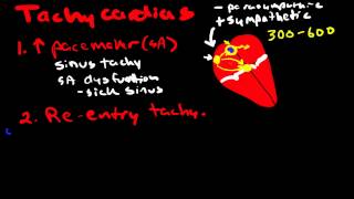 Pathophysiology of Cardiac Arrhythmias [upl. by Goer]