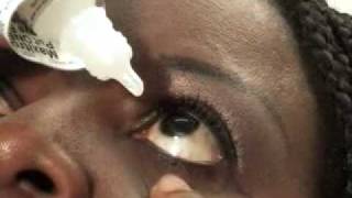 Ophthalmology How to instill your eyedrops [upl. by Rosalba]