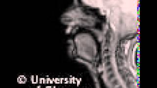 MRI voiceless alveolopalatal fricative [upl. by Enael462]