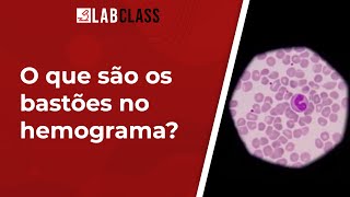 O que são os bastões no hemograma [upl. by Notyap]