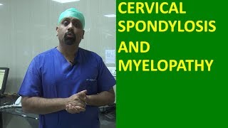 What is Cervical spondylosis Cervical Spinal cord compression and Myelopathy मानेचा संधिवात [upl. by Neumark]