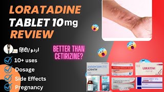 Loratadine  Loratadine 10mg Tablets Used For  Loratadine Tablets 10 mg hindi  Medical Creator [upl. by Fai710]