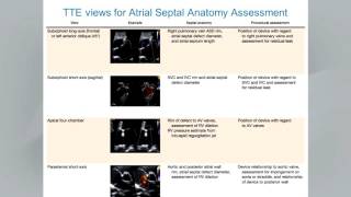 Guidelines for the Echocardiographic Assessment of Atrial Septal Defect amp Patent Foramen Ovale [upl. by Hgielrebmik]