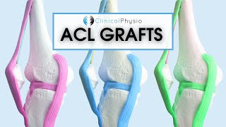 What are the different ACL Grafts  Which one is best Patella vs Hamstring [upl. by Hound]