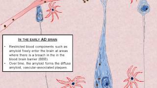 Alternative Hypothesis of Neuronal Death in Alzheimers disease [upl. by Ttirrej228]