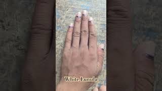 White Lunula Chand significance  Signs in Hand palmistry astrology [upl. by Ajax]