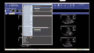 peerVue QICS Peer Review Demo McKesson [upl. by Nochur493]