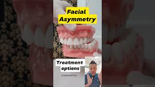 Facial Asymmetry Treatment What Are Your Options dentallan dentist shorts [upl. by Eastlake788]