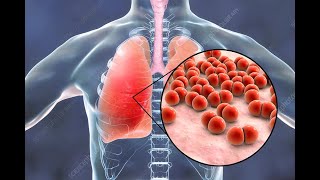 Streptococcus pneumoniae PIA 2023 Microbiología [upl. by Enyrhtac933]