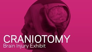 Craniotomy  Traumatic Brain Injury Animation [upl. by Lezned]