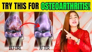 SURPRISING Reasons Why You NEED Glucosamine for Osteoarthritis Doc Cherry [upl. by Hymen]