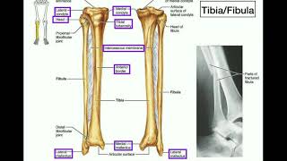 Anatomy  Specific Parts of the Tibia amp Fibula  Left vs Right [upl. by Akemot]