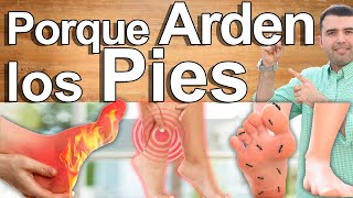 Porqué Me Arden Los Pies  Causas Y Soluciones Para El Ardor Y Dolor En Los Pies [upl. by Aneehsirk]