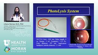 Ocular Pathology IOLs and Capsular Bag Opacification [upl. by Raven]