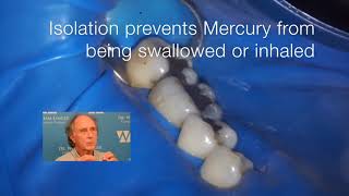 Mercury Amalgam Removal  Tommys Story [upl. by Lan]