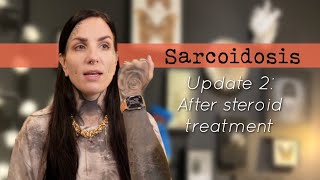 Sarcoidosis update 2 After topical steroid treatment [upl. by Kcirrek]