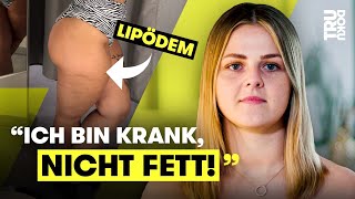 “Fettarsch” – Jolien 24 kämpft gegen Mobbing und Lipödem I TRU DOKU [upl. by Tildie477]