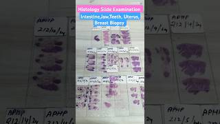 Histology Slide Identification histology histopathology shots shorts ytshortsLabTechnicianStudy [upl. by Suoicerpal]