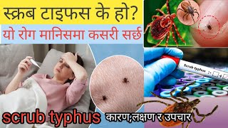 scrub typhusस्क्रब टाइफस के होयो रोग कसरी सर्छकारणलक्षण र उपचार [upl. by Ednew]