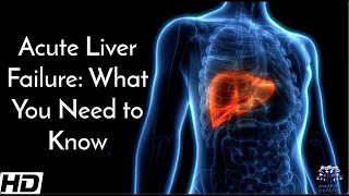 Acute Liver Failure What You Need To Know [upl. by Bonita723]