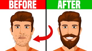 How to Deal With a Patchy Beard [upl. by Gnot556]