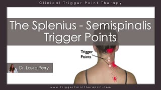 The Splenius and Semispinalis Trigger Points [upl. by Faulkner]