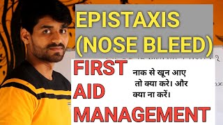 EPISTAXIS NOSE BLEED FIRST AID MANAGEMENT [upl. by Htial]