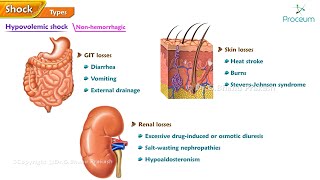 2Shock Hypovolumic Shock Cardiogenic Shock Obsructive Shock Distributive Shock [upl. by Risay]