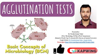 Agglutination tests I Immunology I Hemagglutination tests I Hemagglutination Inhibition tests I [upl. by Trinette231]