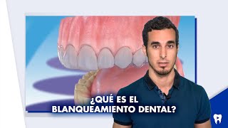 ¿Qué es el BLANQUEAMIENTO dental ¿En qué consiste  Shorts [upl. by Hoyt304]