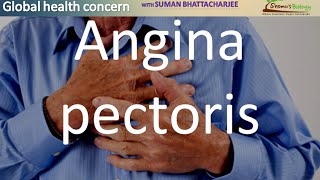 Angina pectoris [upl. by Violette]