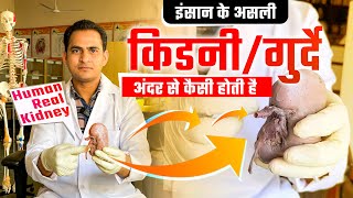 HUMAN REAL KIDNEY amp KIDNEY STONES  किडनीगुर्दे अंदर से कैसी होती है और इसमें पथरी कहाँ बनती है [upl. by Cinnamon]